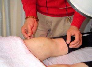 Коксартроз коленного сустава — заболевание которого не существует - подробности о болезнях суставов на Diet4Health.ru