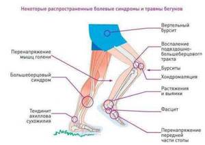 Насколько вреден бег для наших суставов? - подробности о болезнях суставов на Diet4Health.ru