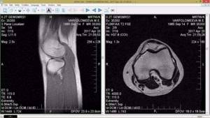 Как проходит и сколько стоит МРТ коленного сустава? Что показывает и сколько времени длиться? - подробности о болезнях суставов на Diet4Health.ru