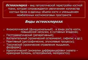 Посттравматический артроз - подробности о болезнях суставов на Diet4Health.ru