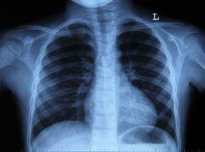 Отличие МРТ от рентгена. Можно ли делать МРТ и рентген в один день? - подробности о болезнях суставов на Diet4Health.ru