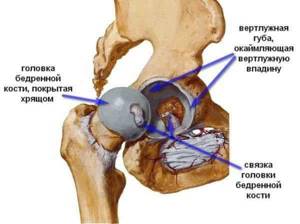 Лечение деформирующего артроза тазобедренного сустава 1, 2 и 3 степени - подробности о болезнях суставов на Diet4Health.ru