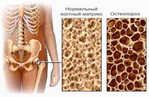 Как пить желатин для лечения суставов - подробности о болезнях суставов на Diet4Health.ru