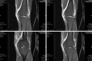 Как делают и что показывает МРТ локтевого сустава? - подробности о болезнях суставов на Diet4Health.ru