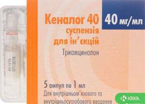 Лечим лигаментит коленного сустава и связки надколенника - подробности о болезнях суставов на Diet4Health.ru
