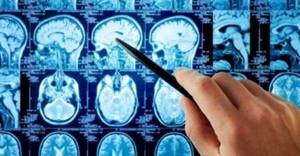 Отличие МРТ от МСКТ головного мозга - подробности о болезнях суставов на Diet4Health.ru