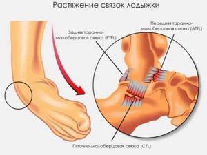 МРТ голеностопного сустава - подробности о болезнях суставов на Diet4Health.ru МРТ голеностопного сустава - подробности о болезнях суставов на Diet4Health.ru