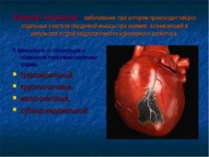 НПВС и сердечно-сосудистая система: осложнения и их профилактика - подробности о болезнях суставов на Diet4Health.ru