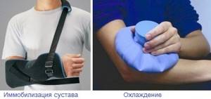 Методы лечения растяжений связок локтевого сустава - подробности о болезнях суставов на Diet4Health.ru