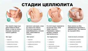 Антицеллюлитный массажер - всё о правильном питании для здоровья на Diet4Health.ru