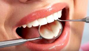 5 фактов о здоровье зубов, которые мало кому известны - здоровое питание на Diet4Health.ru